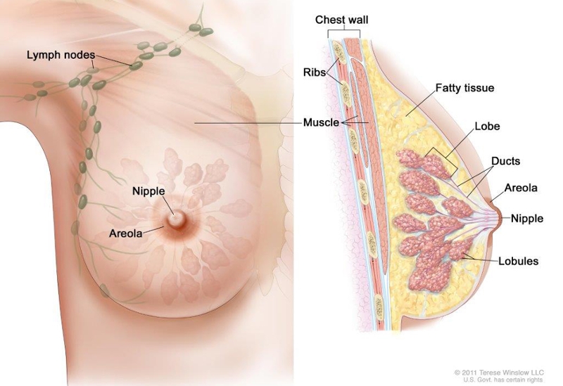 Anatomy of the female breast. The nipple and areola are shown on the outside of the breast. The lymph nodes, lobes, lobules, ducts, and other parts of the inside of the breast are also shown.