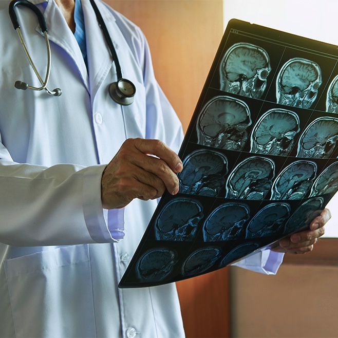 Picture of male doctor holding a brain scan