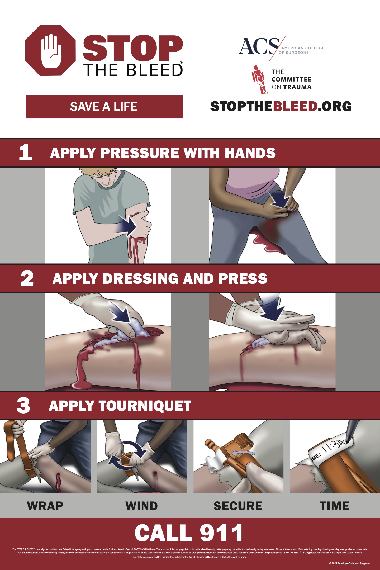 Stop the Bleed Save a Life Steps