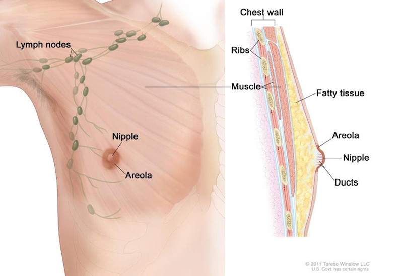 Anatomy of the male breast. The nipple and areola are shown on the outside of the breast. The lymph nodes, fatty tissue, ducts, and other parts of the inside of the breast are also shown.