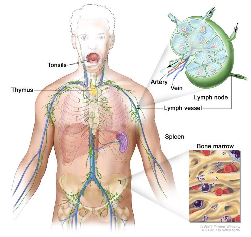 Anatomy of the lymph system, showing the lymph vessels and lymph organs including lymph nodes, tonsils, thymus, spleen, and bone marrow. Lymph (clear fluid) and lymphocytes travel through the lymph vessels and into the lymph nodes where the lymphocytes destroy harmful substances. The lymph enters the blood through a large vein near the heart.
