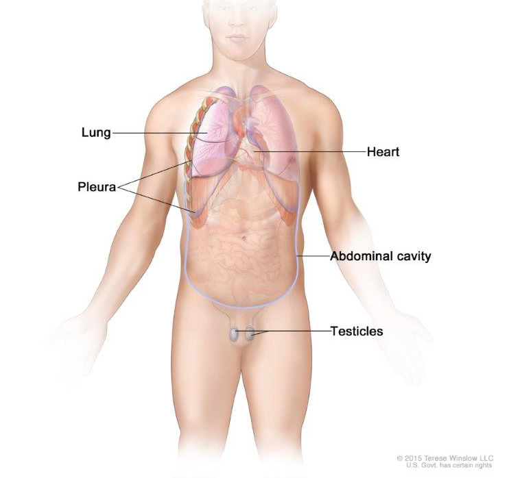 Malignant mesothelioma forms in the thin layer of tissue that covers the lung, chest wall, abdomen, heart, or testicles.