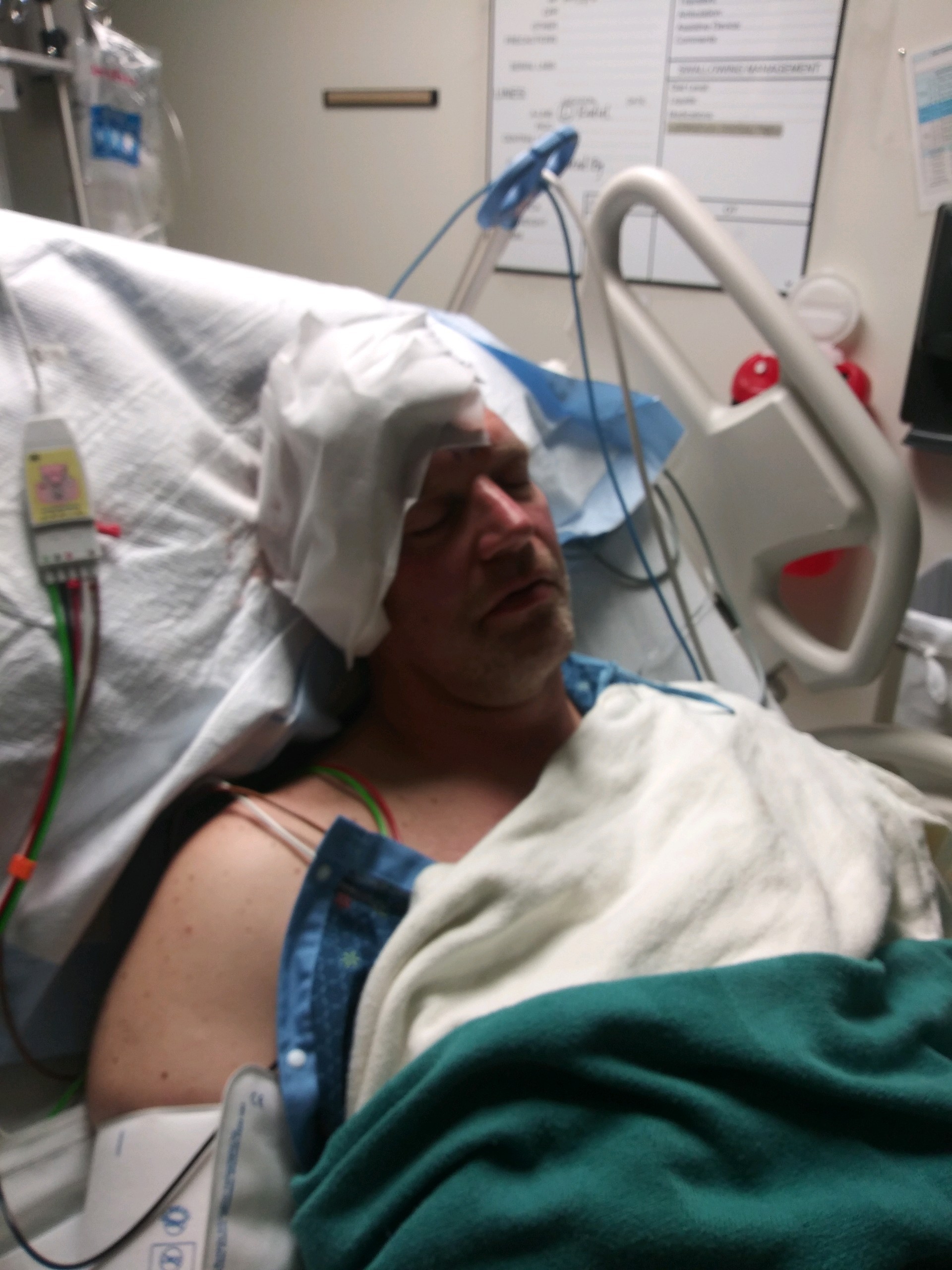 Dave Perry in hospital bed with gauze on his head after surgery