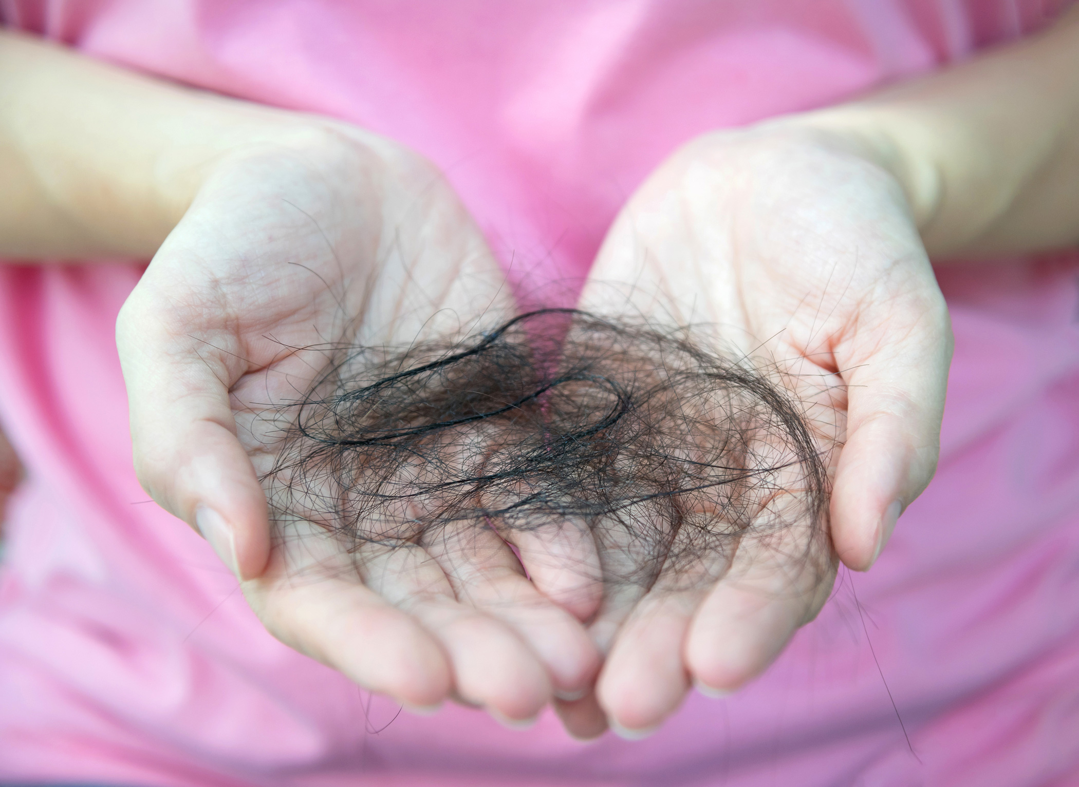 Woman holding clump of hair in her hands