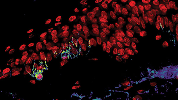 Melanocytes in human skin