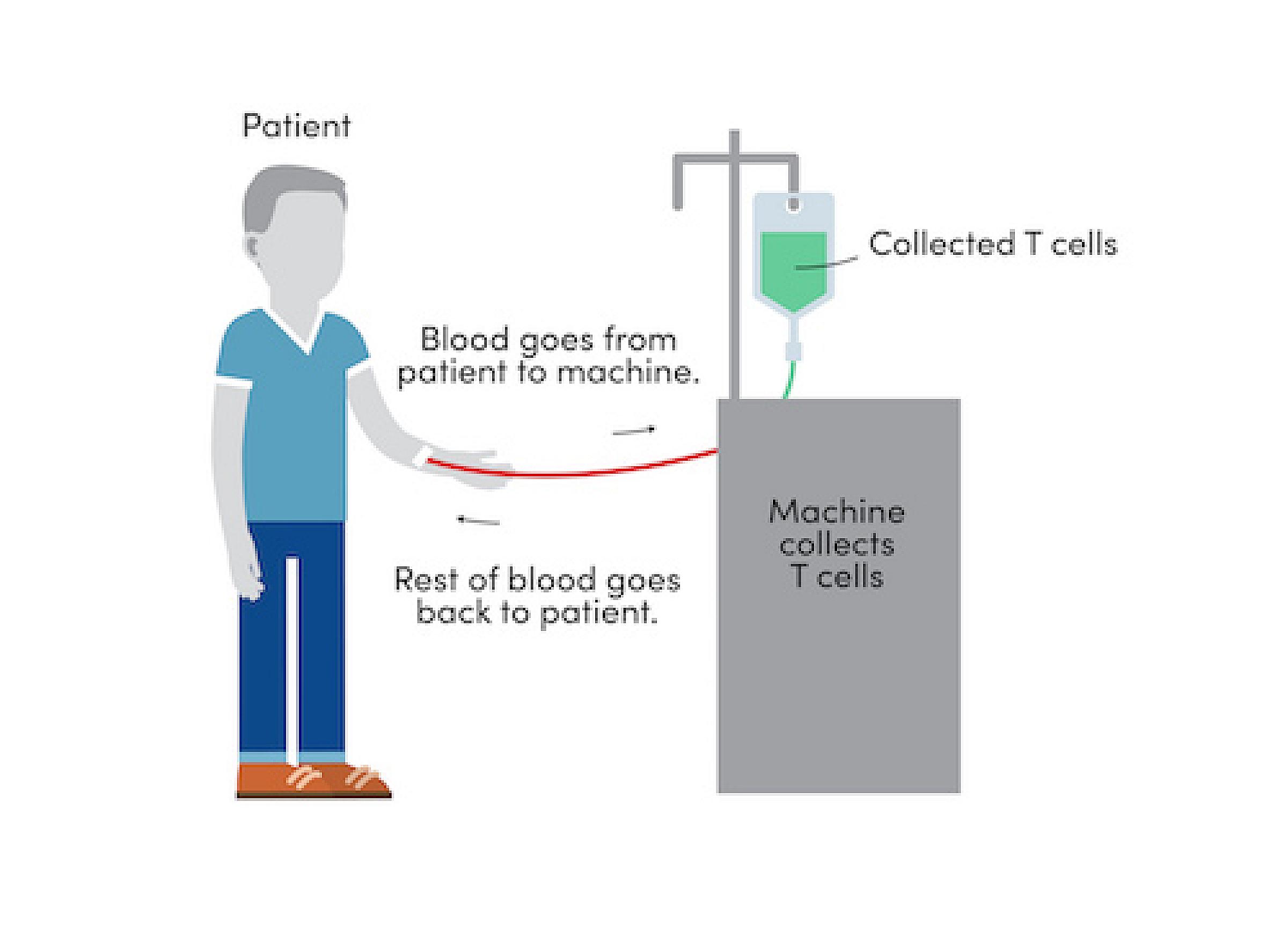 Graphic showing blood going from patient to machine where T cells are collected and the rest of the blood goes back to the patient