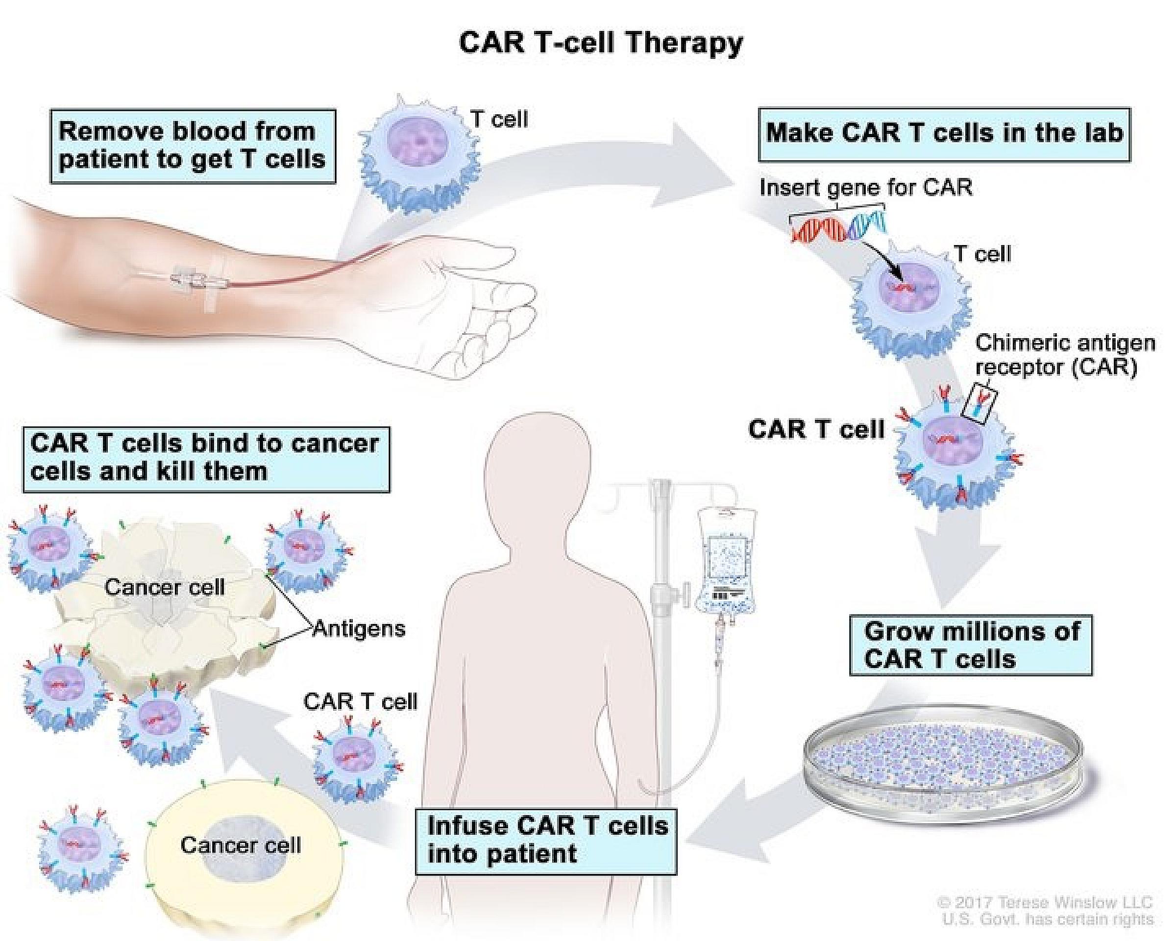 Image of CAR T Cell Therapy Process