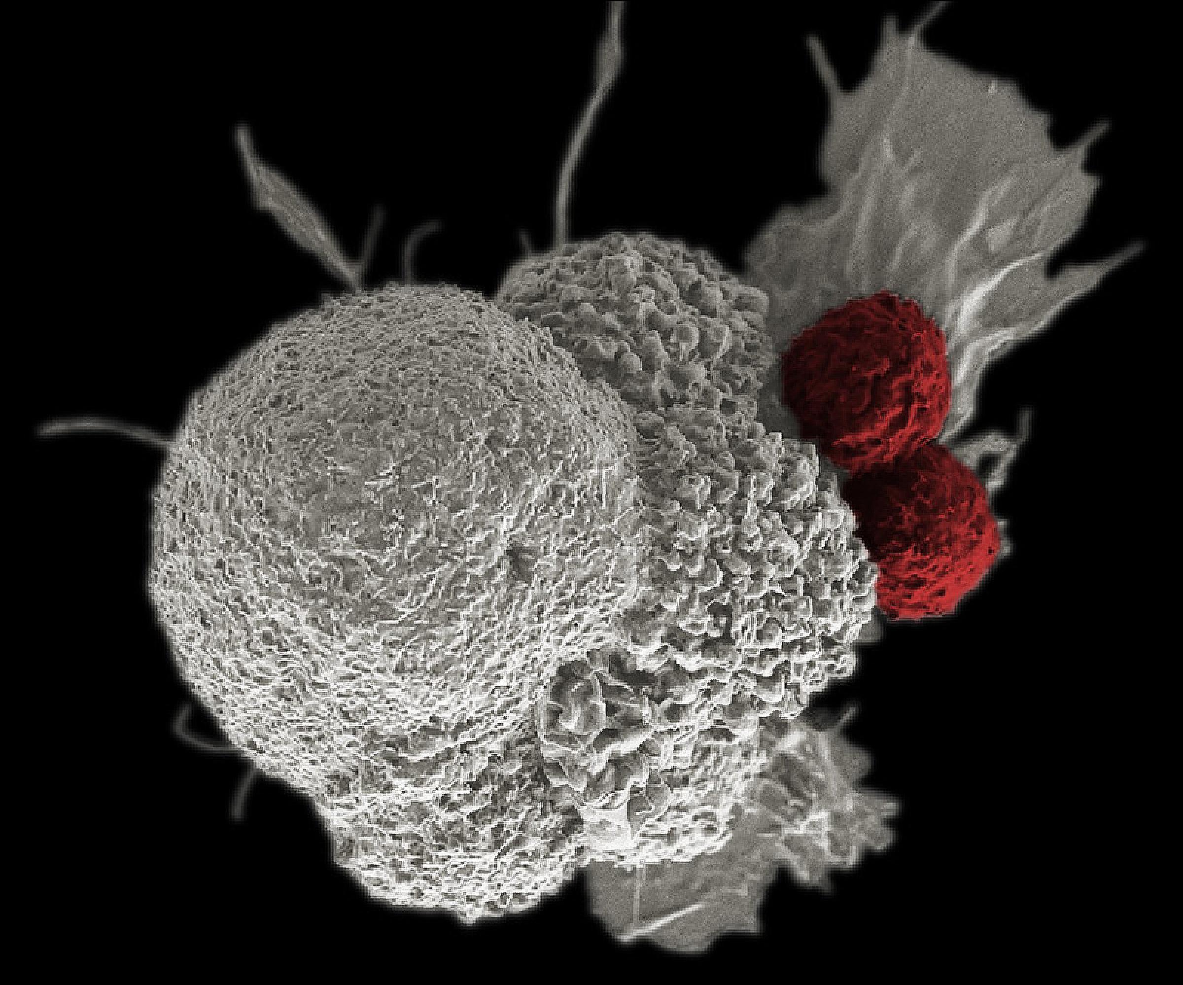 Cancer immunotherapy on a cell level