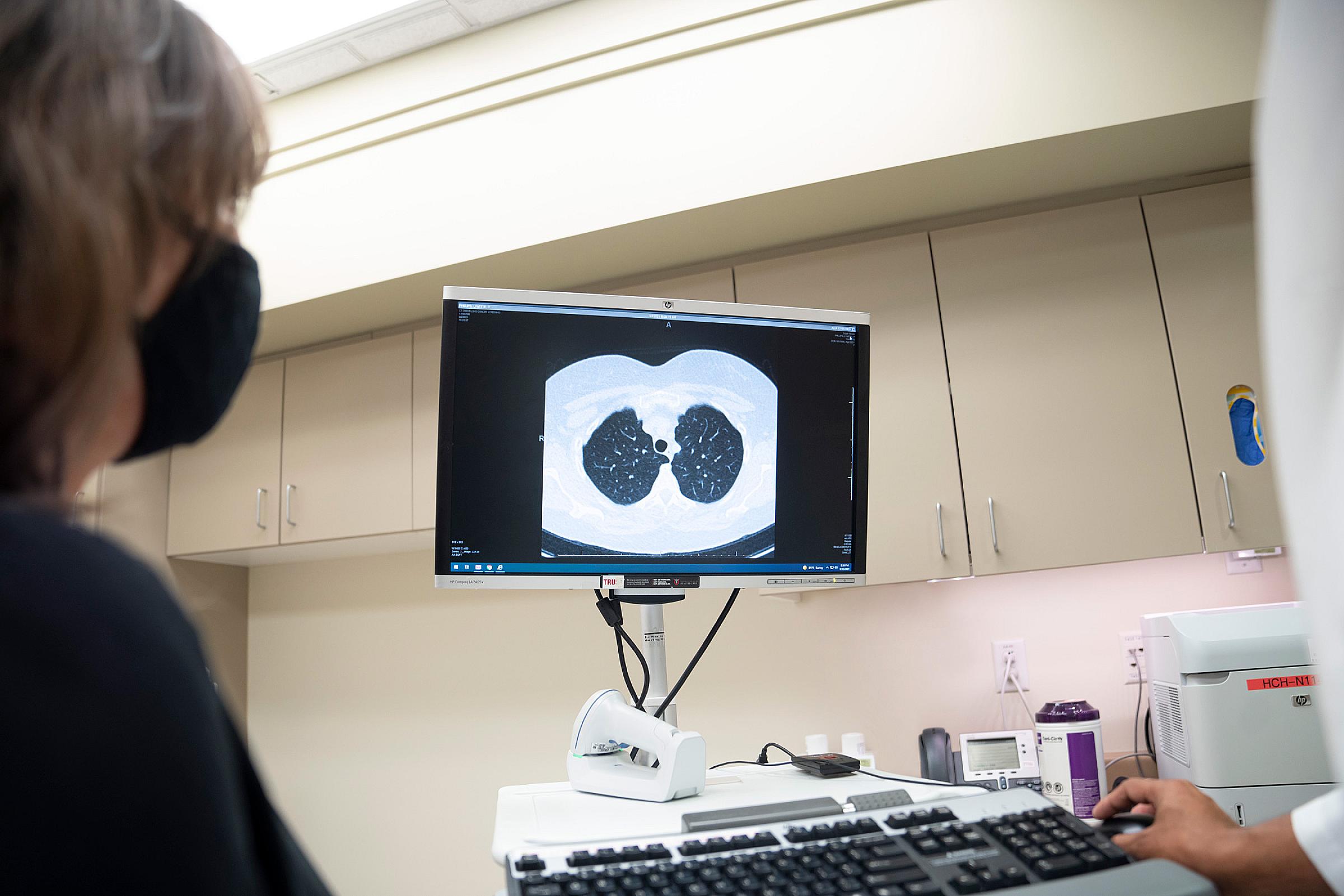 Patient and doctor look at imaging of lung cancer screening on computer monitor