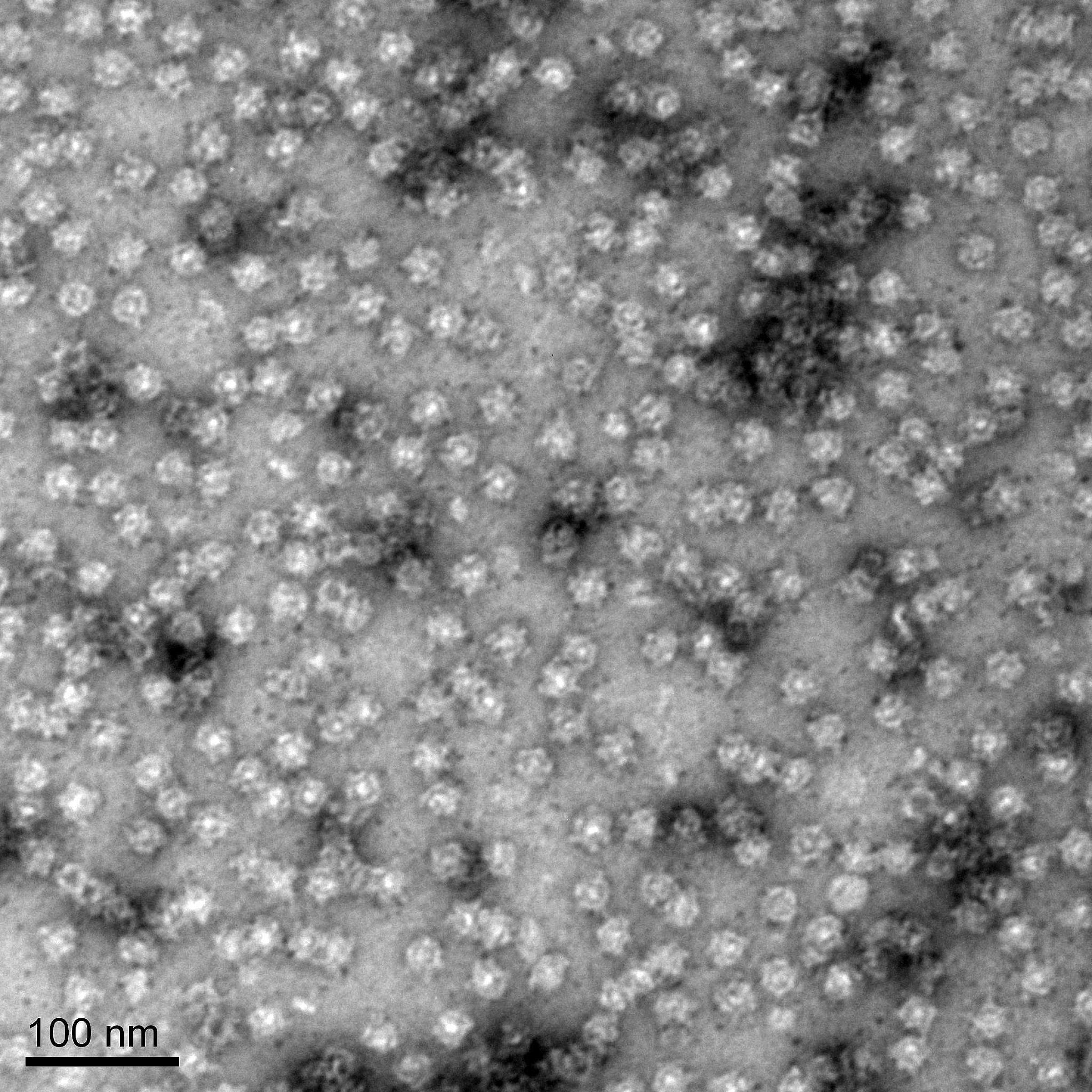 Microscope image of PNMA2 proteins. Each starlike particle is a separate 12-sided complex.