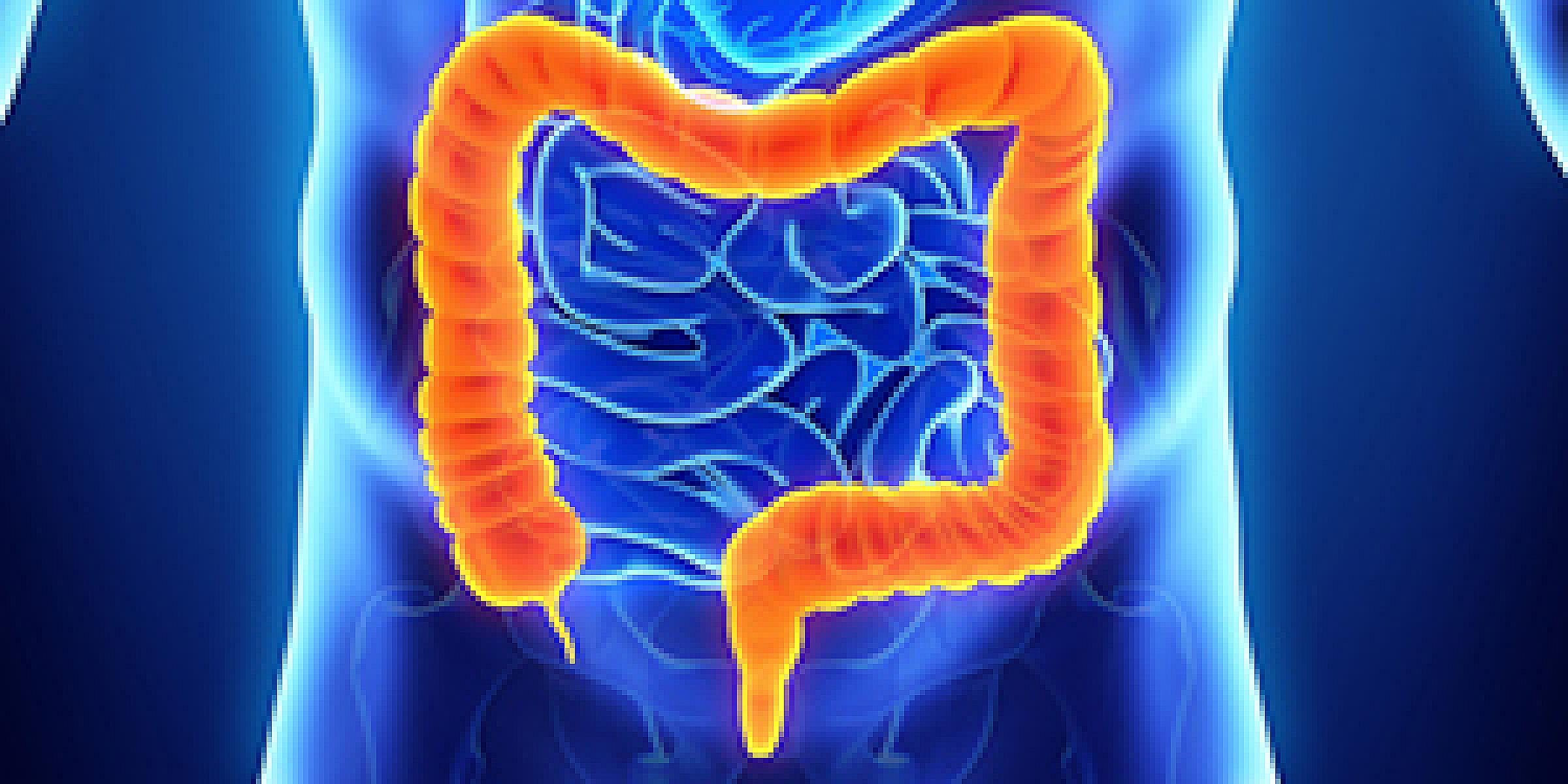 3D rendering of colon