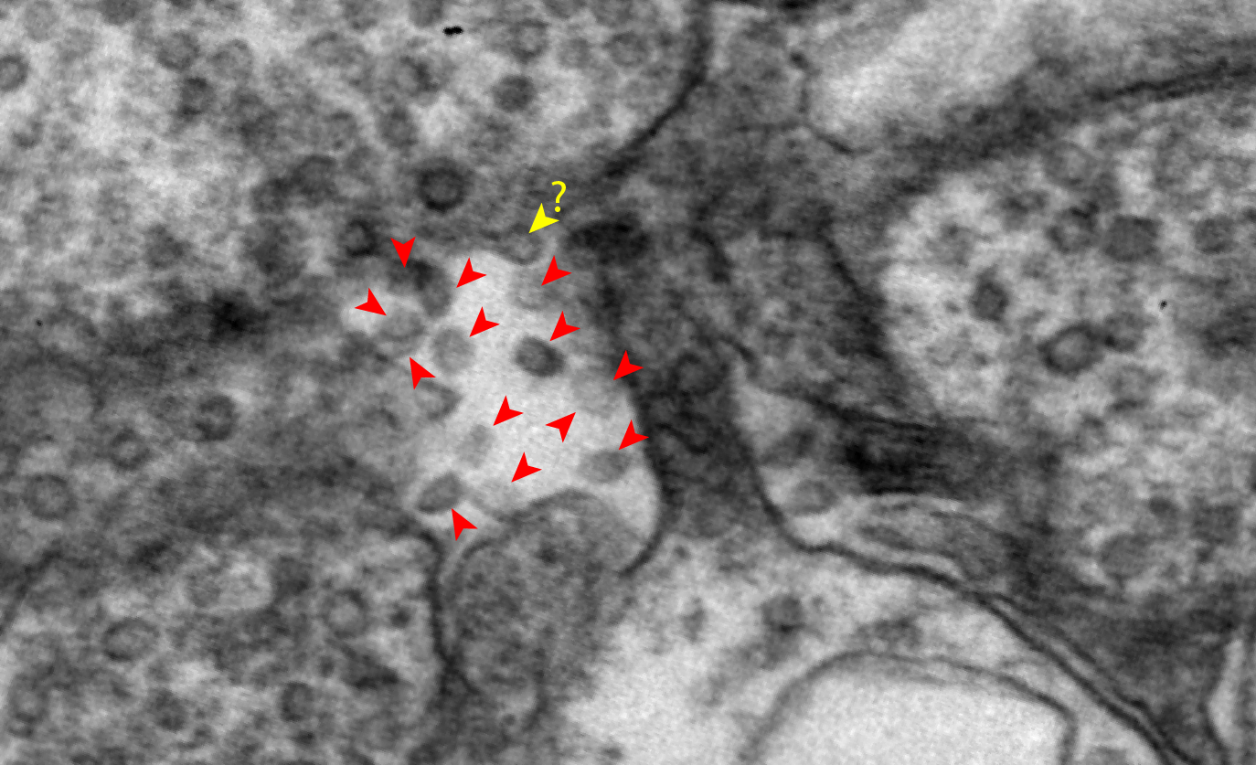 Microscopic imaging of exosomes, the subject of glaucoma research in the McDonnell Laboratory.