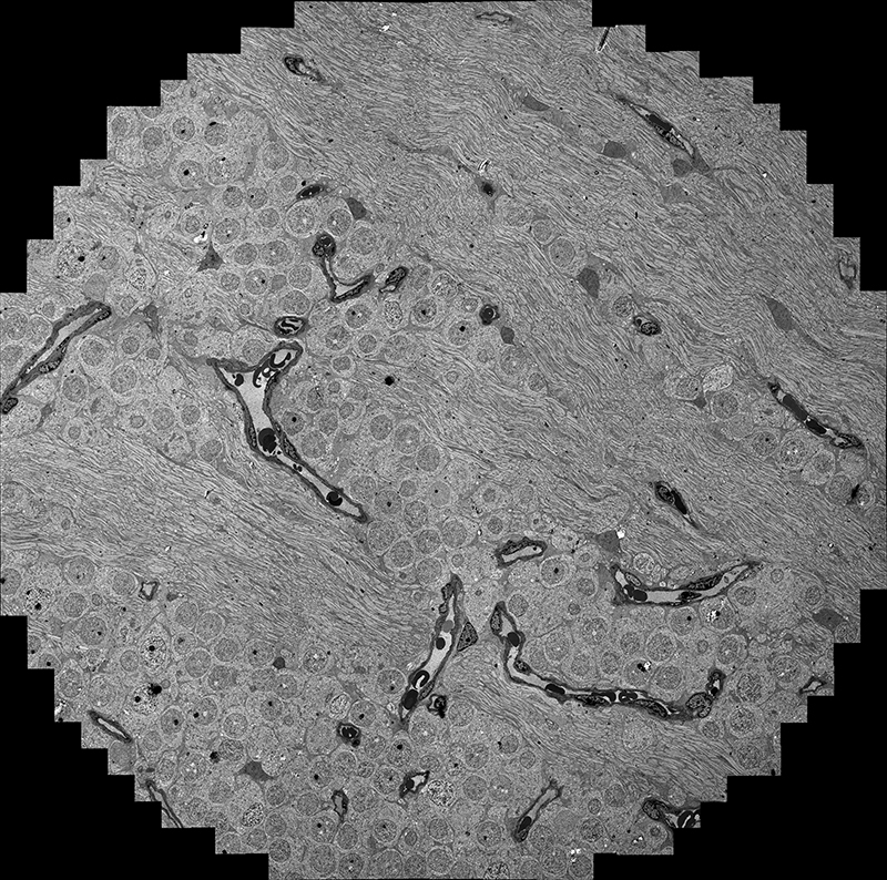 A 900-image composite of a retina is shown, made on the new transmission electron microscope and camera funded by the Dee Foundation. The microscope captures data twice as fast as an older one used in the Moran lab of Bryan W. Jones.