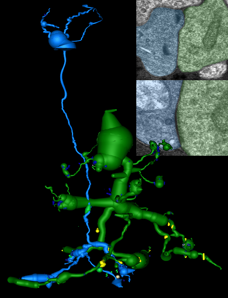    A 2-D pathoconnectome image showing two retinal neurons (rod bipolar cell in blue, Aii amacrine cell in green). A gap junction connection (lower inset image) is not normally present between them but formed as the degenerating retina rewired itself during disease.