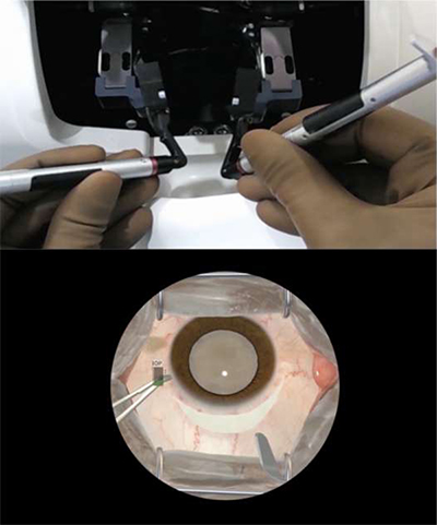 A trainee uses simulator handpieces to interact with the eye model, bottom, realistically.