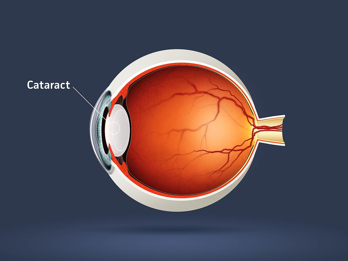 eye anatomy diagram