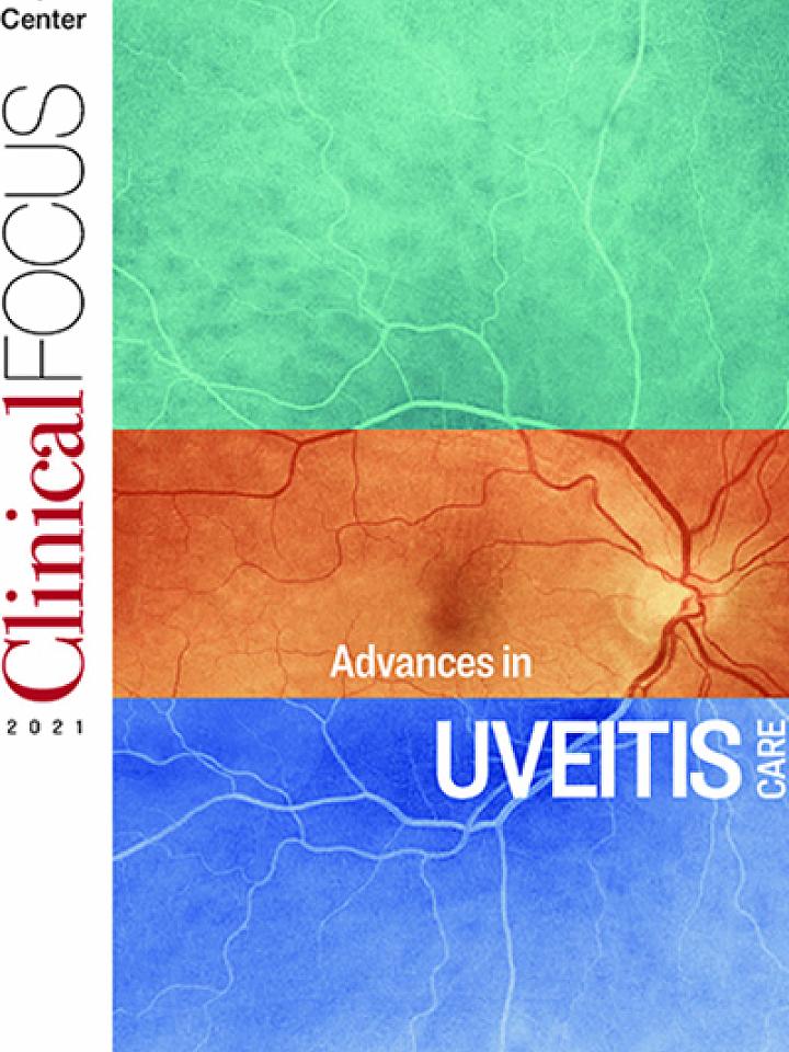 Clinical Focus 2021: Advances in Uveitis Care