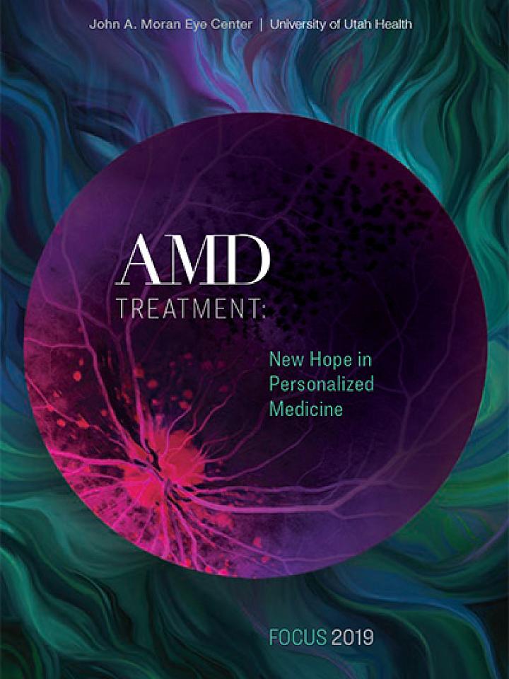 AMD Treatment: New Hope in Personalized Medicine