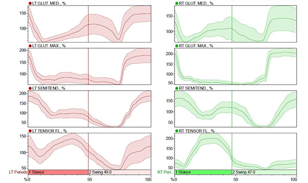 Read out from  surface electromyography