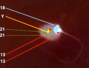 A fertility test analyzing sperm with fluorescent in-situ hybridization (FISH)