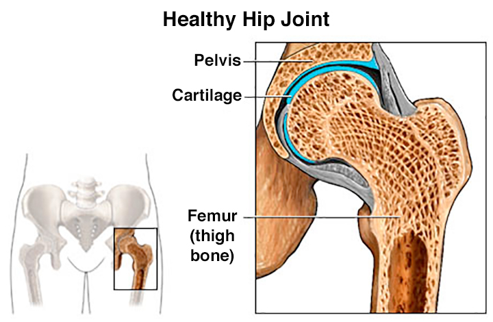 Picture of a healthy hip joint