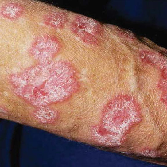 What's that Rash? How to ID Common Rash Symptoms | The Healthy