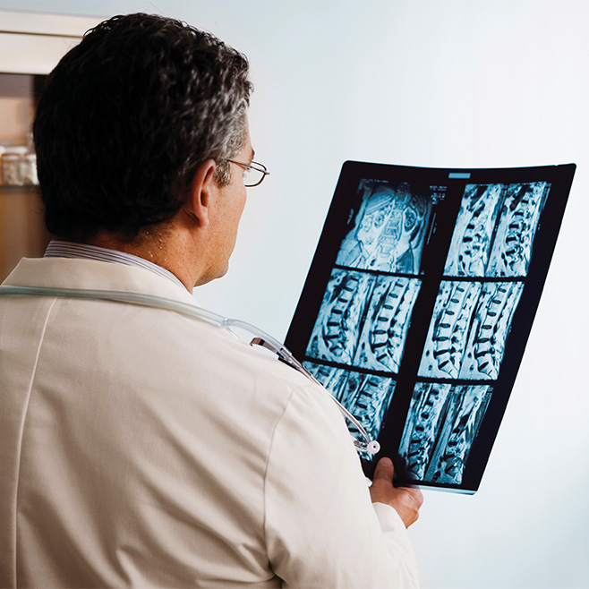 Doctor examines spinal cord X-ray