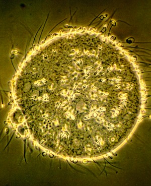 A hamster egg penetration test used to evaluate male infertility.