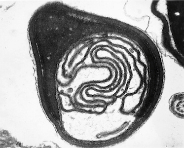 A sperm viewed through transmission electron microscopy. This allows us to see inside the sperm and its components.