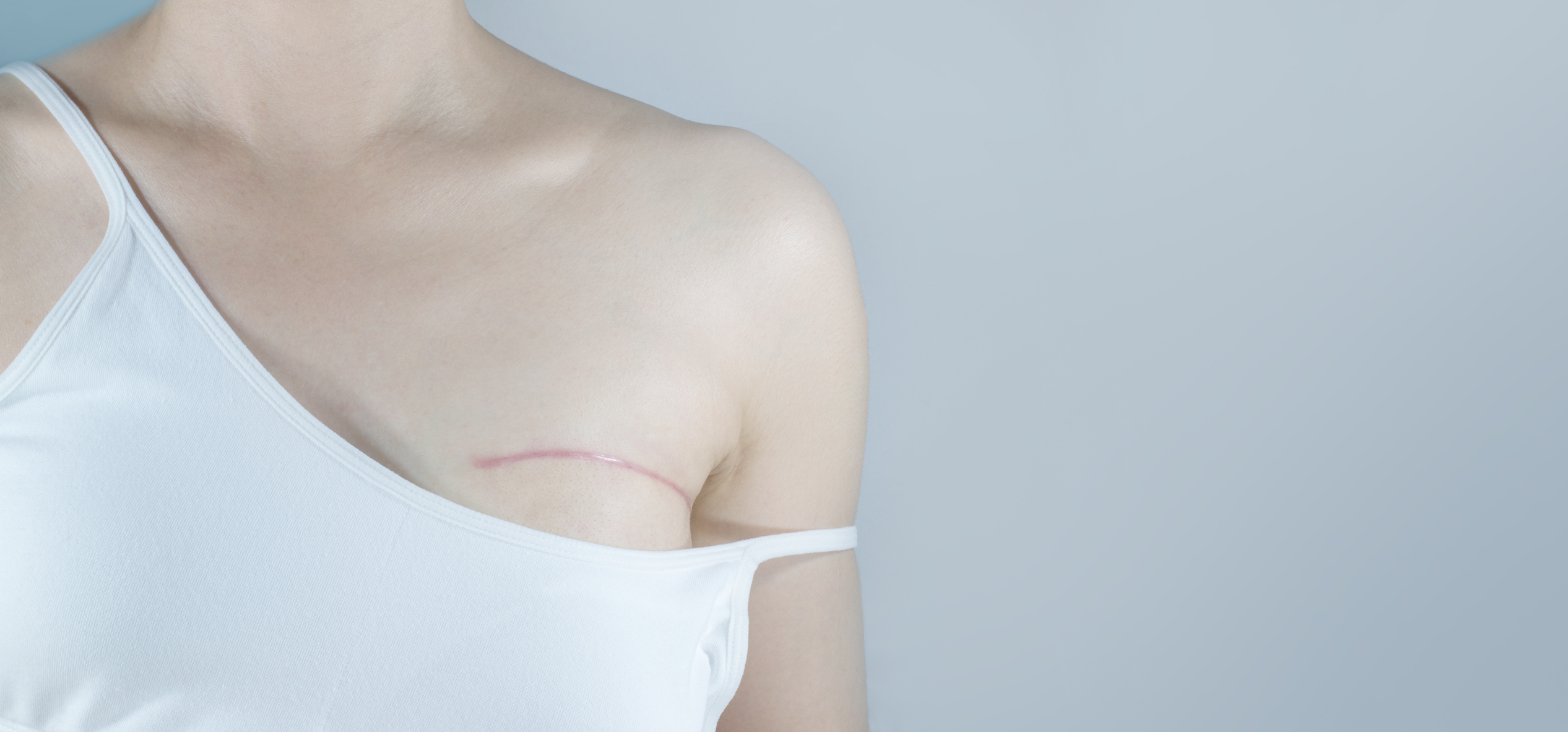 Breast Reconstruction Options Following a Mastectomy