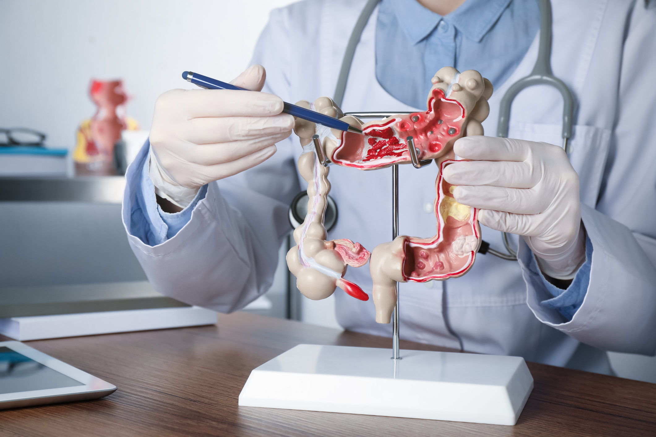 Seven Questions for a Gastroenterologist