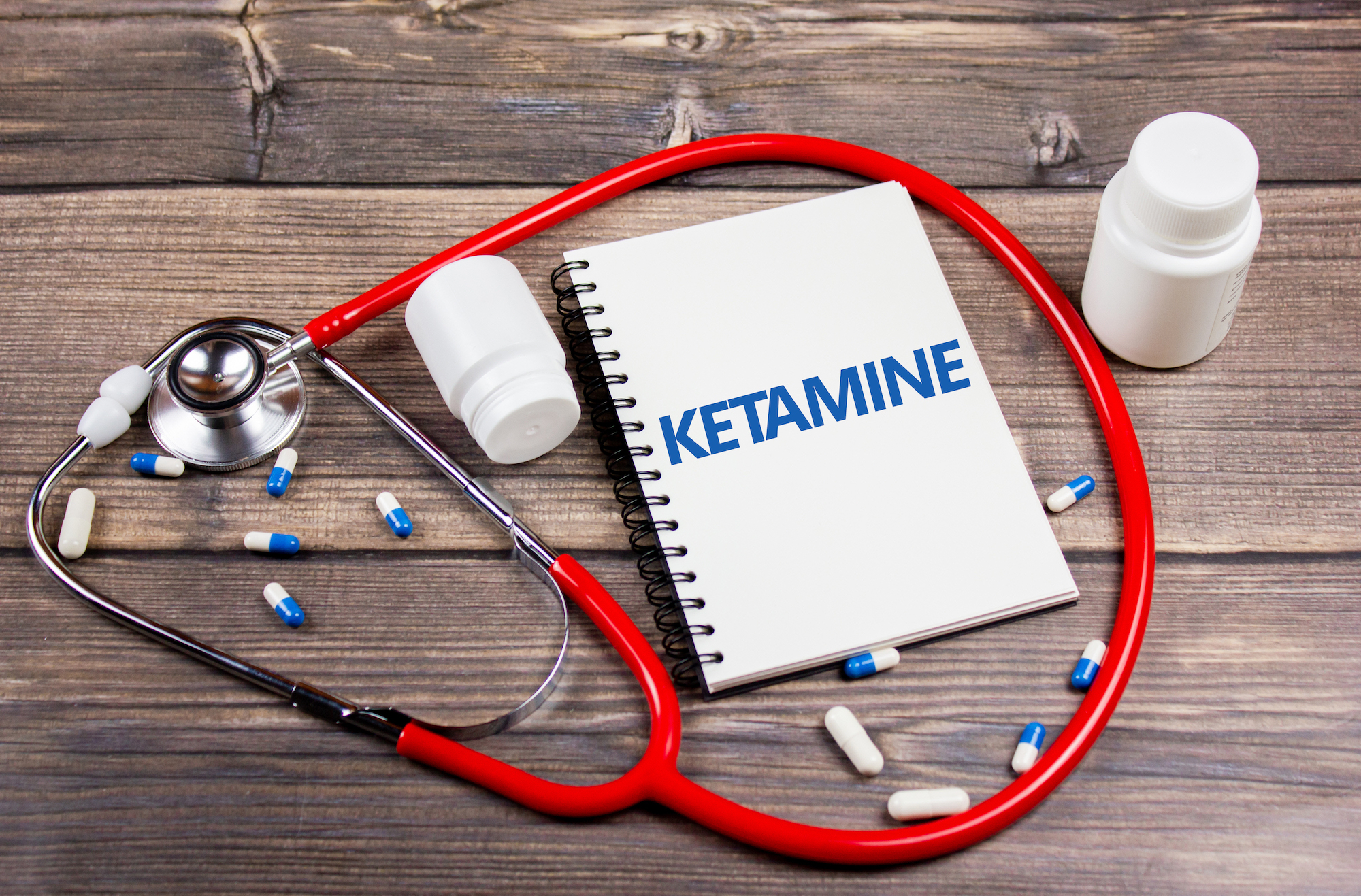 Fast Facts About Ketamine for Depression | University of Utah Health