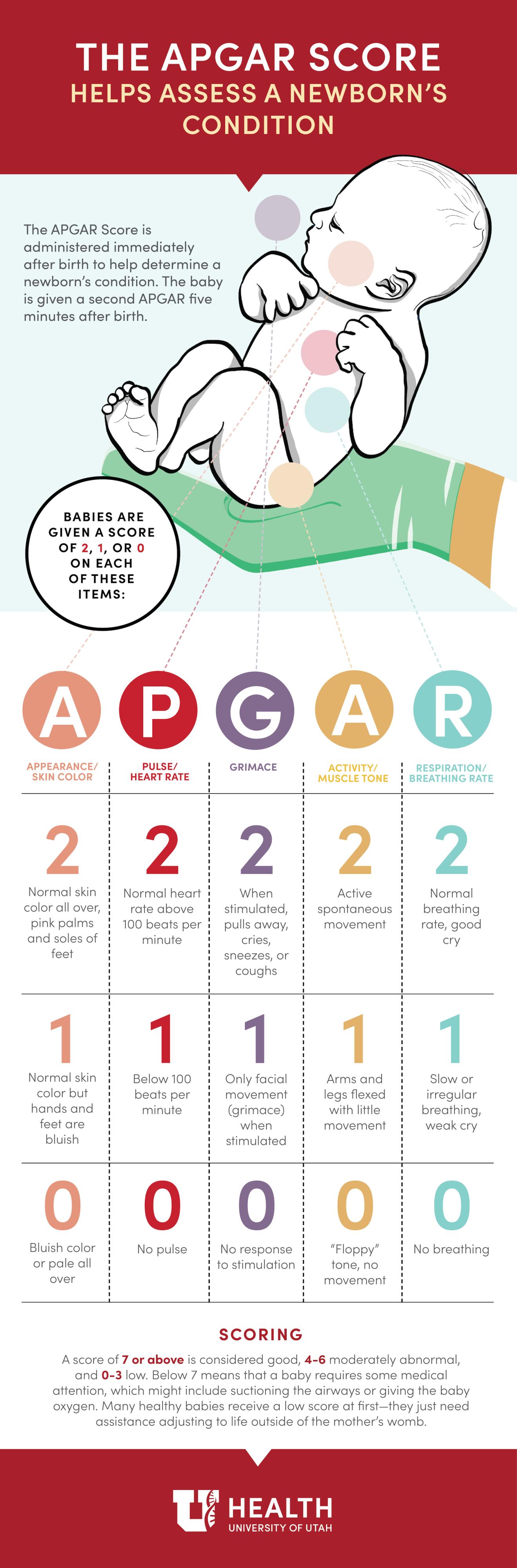 APGAR Score infographic