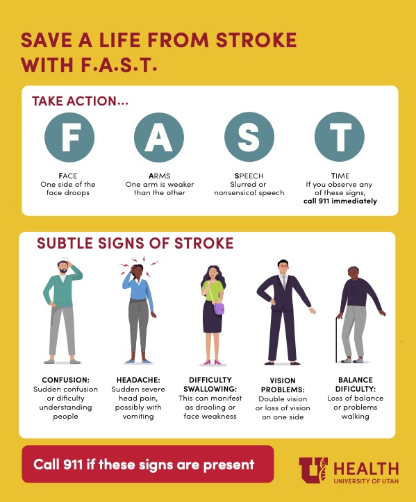 FAST Stroke symptoms