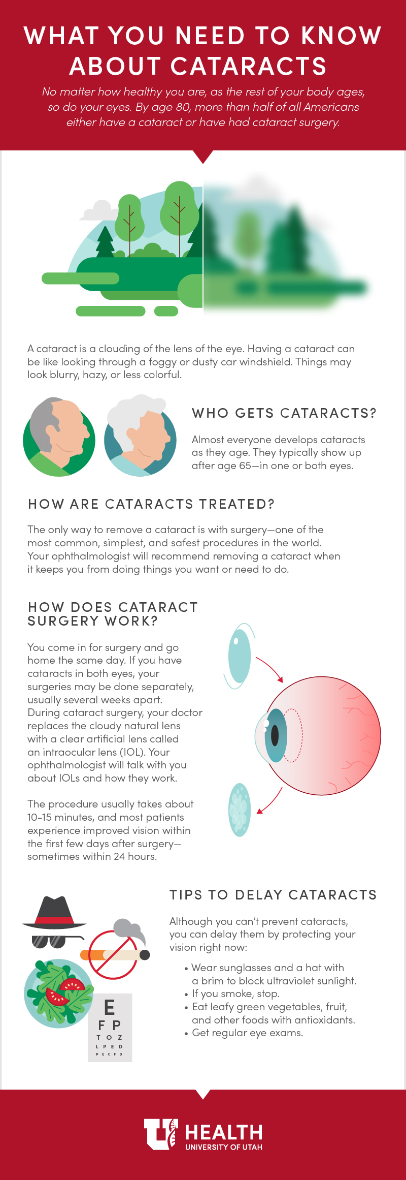 infographic-cataracts.jpg