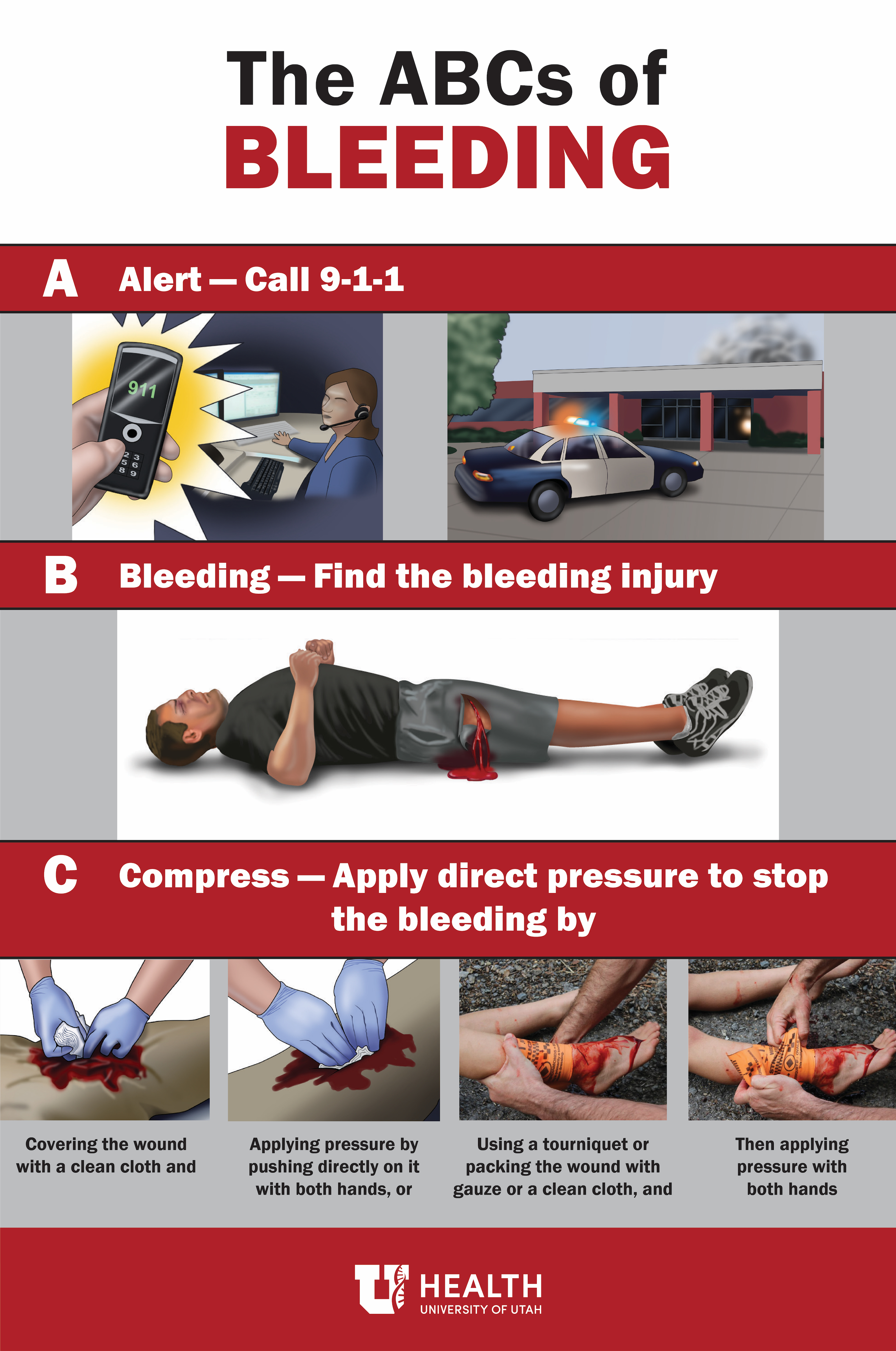 Stop the Bleed ABCs
