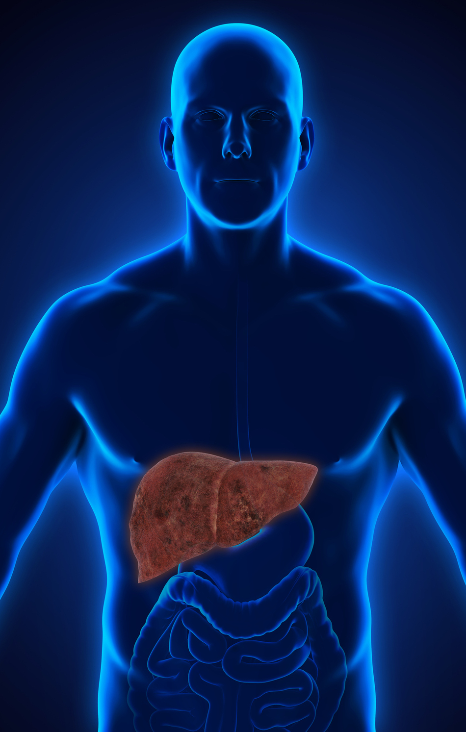 Could You Have Fatty Liver Disease?