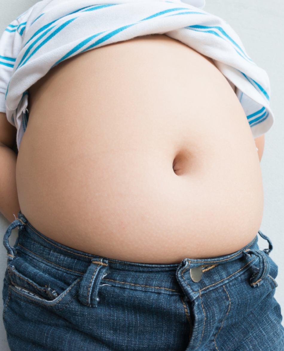 Why Isn’t America’s Childhood Obesity Problem Getting Better?