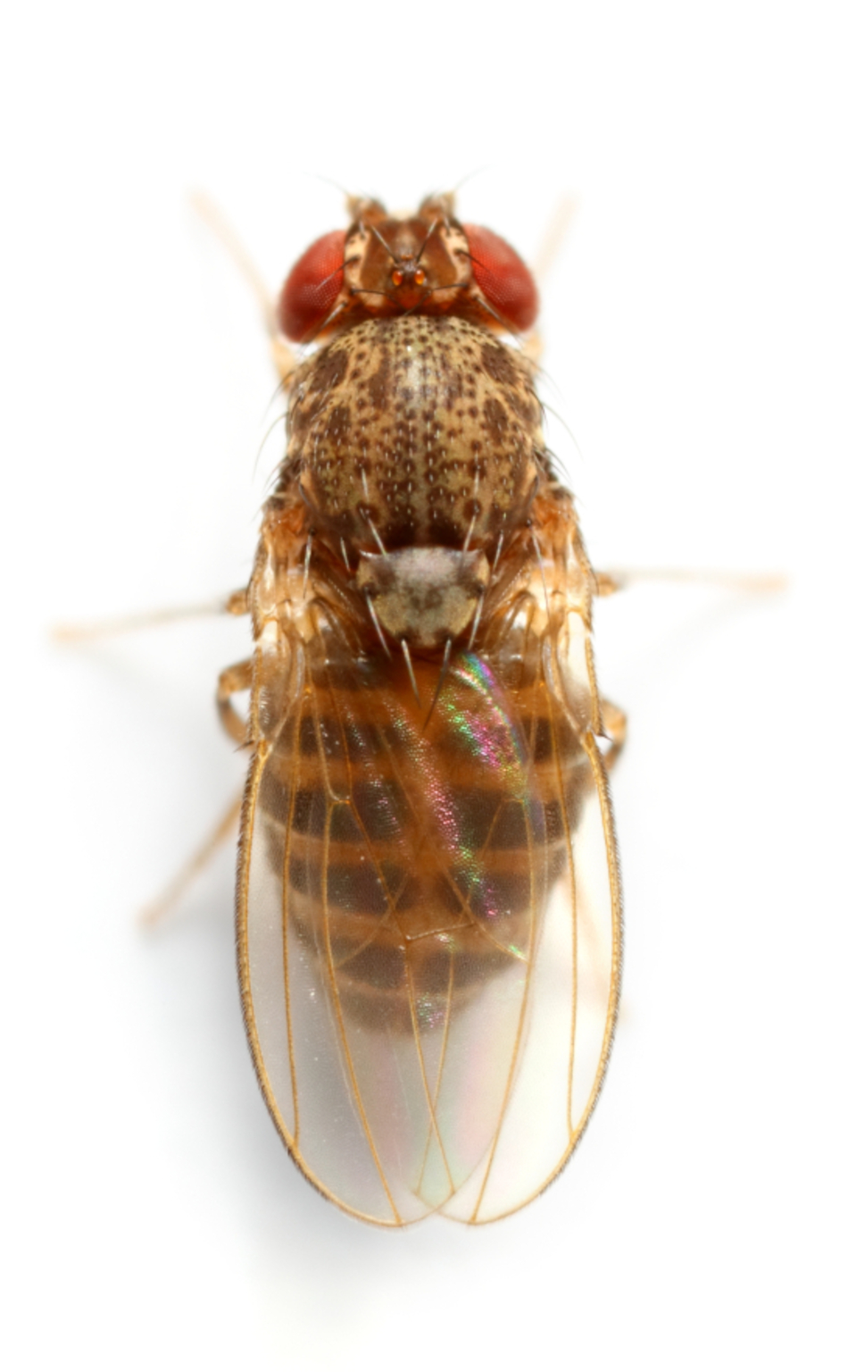 What Humans Can Learn From Diabetic Flies