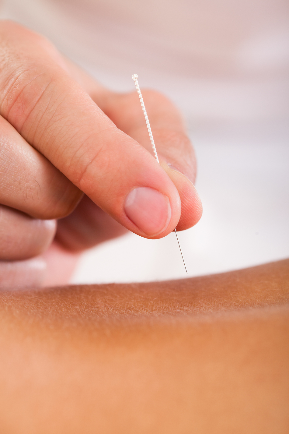 Menopause and Acupuncture