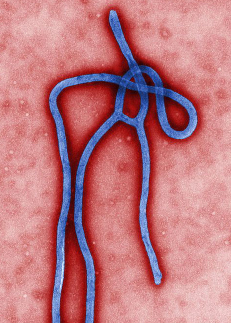 A Universal Drug Target for Preventing Ebola