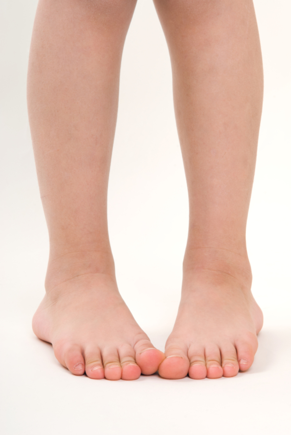 Does Your Child Have Pigeon Feet? When It's Normal – And When It's Not
