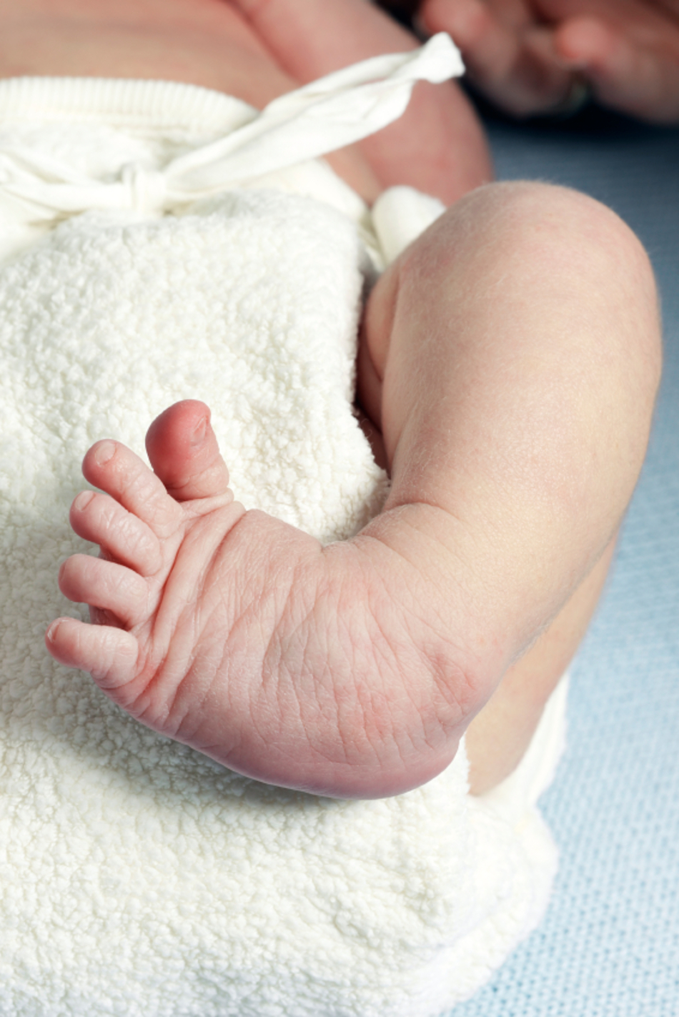 Birth Defects Aren’t as Rare as You Think: 1 in 33 Babies is Born with One