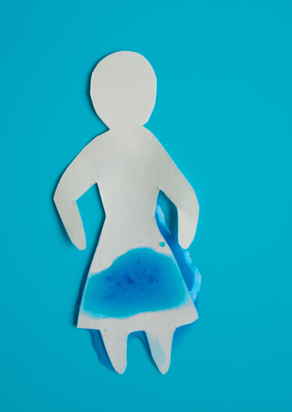 Do You Urinate a Lot? It Might Be Diabetes