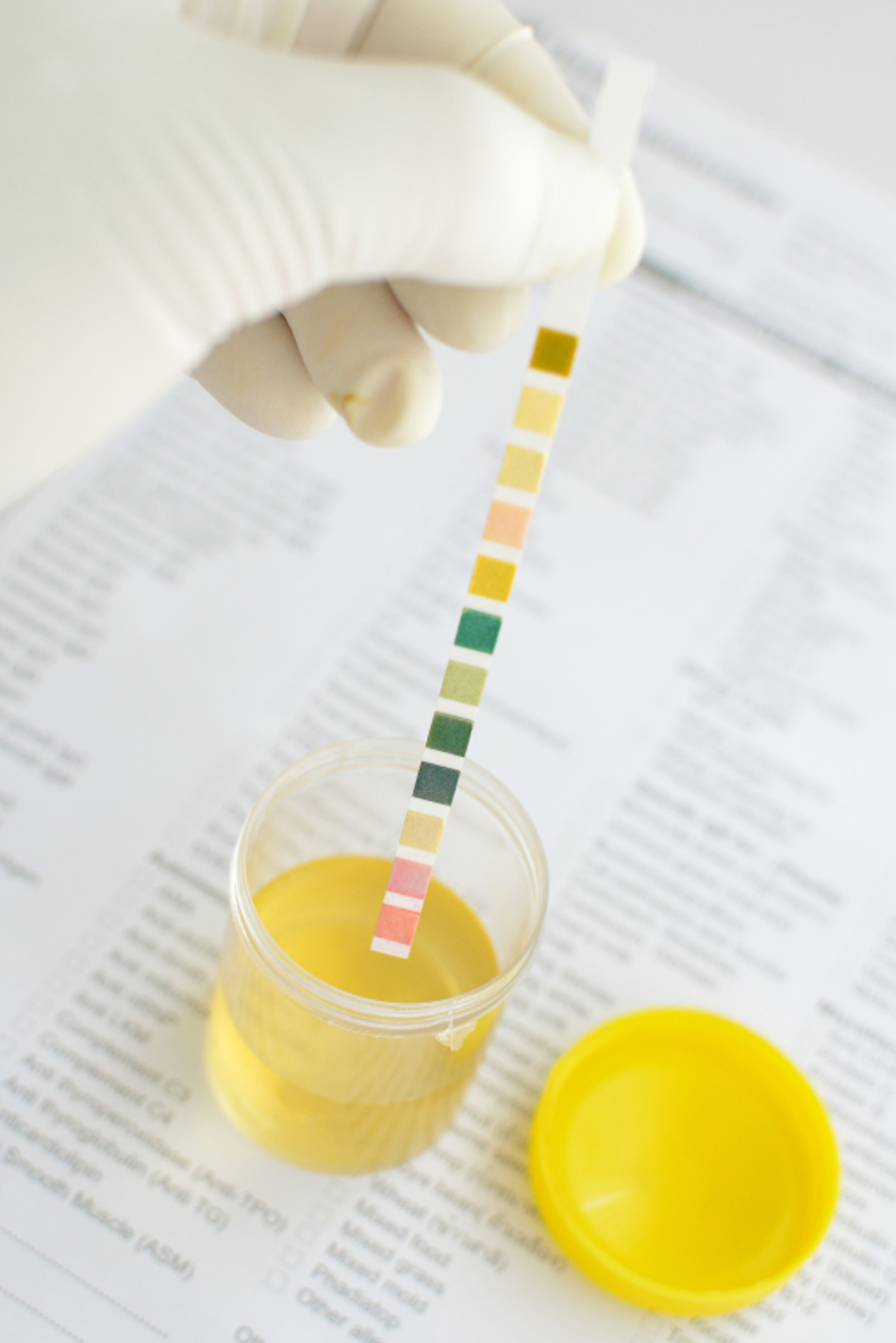 Blood in the Urine - Should You Be Concerned?