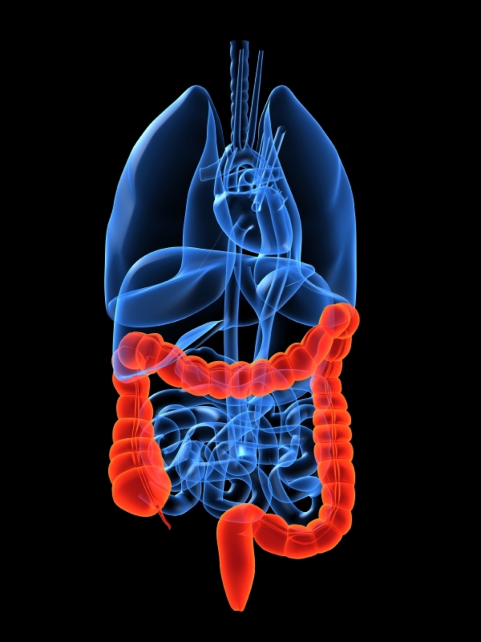 Screening Guidelines May Fail to Catch 10 Percent of Colon Cancers