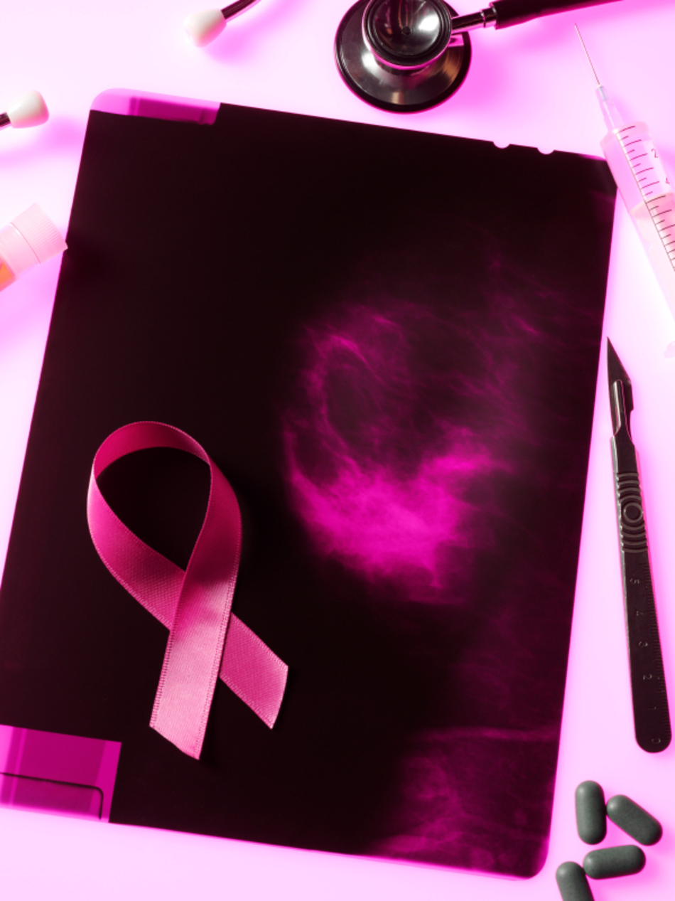 Are Mammograms as Effective as We Thought?