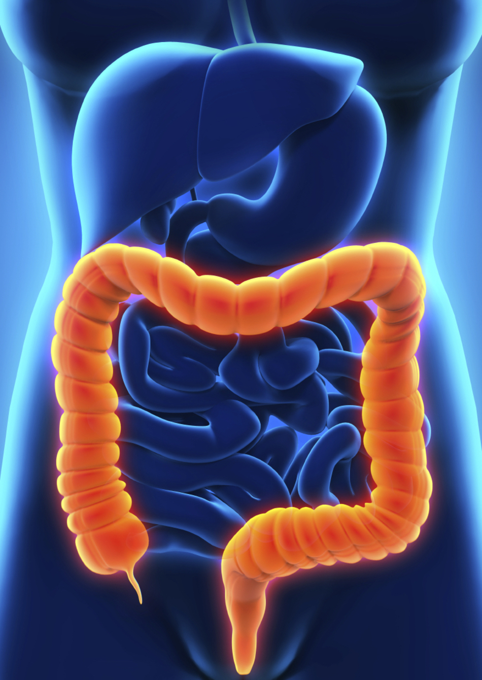 Overwhelmed with Information on Colorectal Cancer Treatment? Talk to Your Doctor