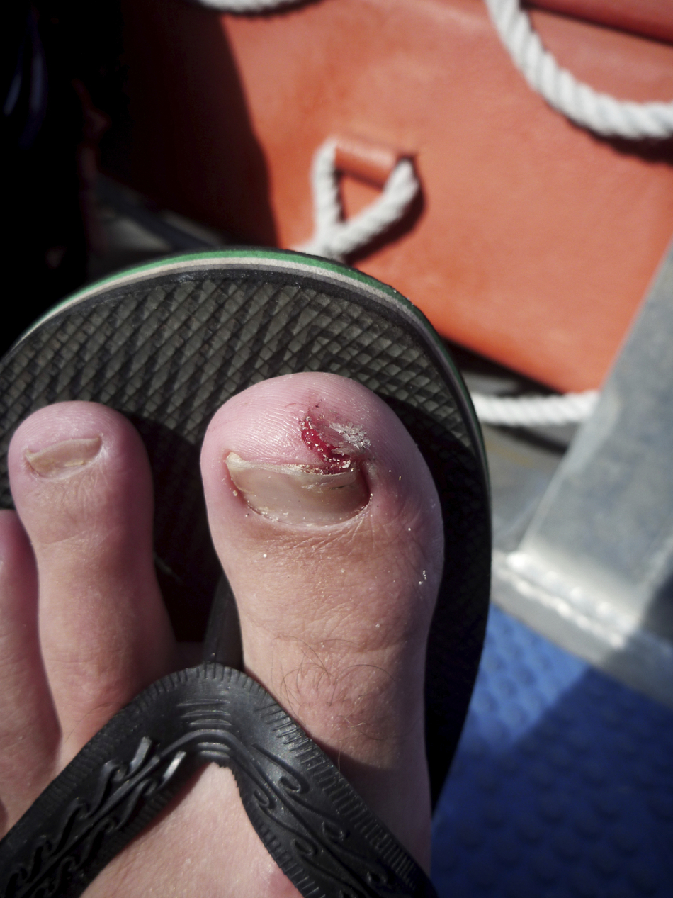 ER or Not: Really Bad Stubbed Toe