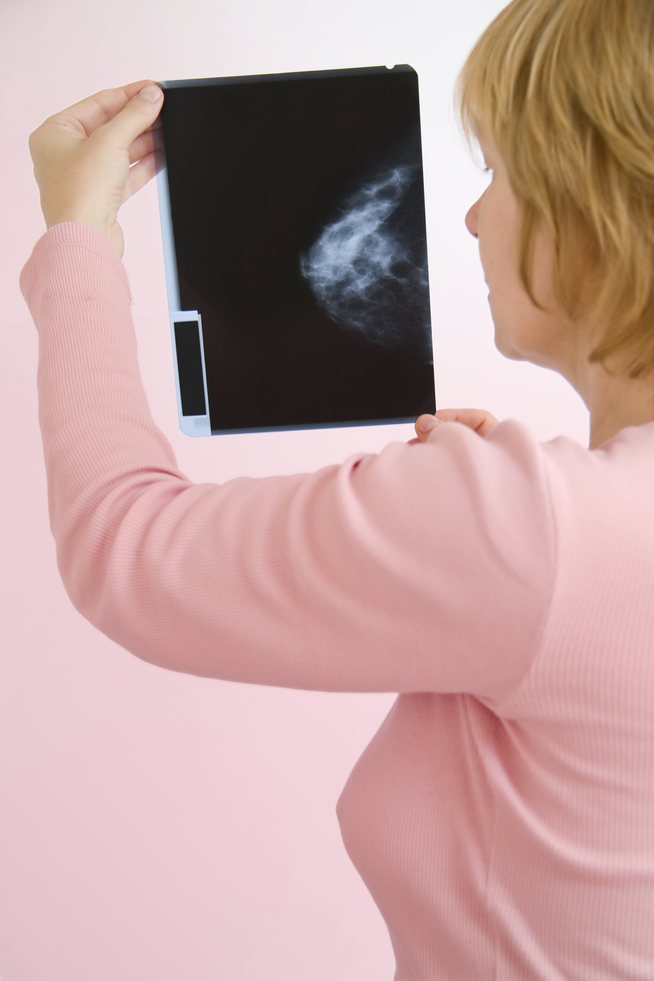 Mammograms: Screening vs. Diagnostic